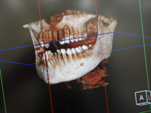 CT、頭部X線規格写真（セファログラム）